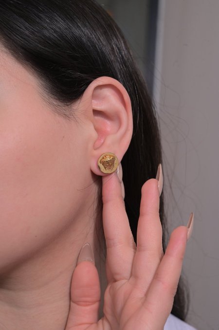 حلق فيرزاتشي